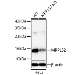 Western Blot - Anti-MRPL52 Antibody (A329637) - Antibodies.com