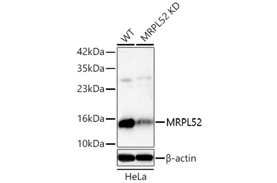 Western Blot - Anti-MRPL52 Antibody (A329637) - Antibodies.com
