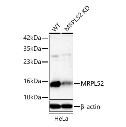 Western Blot - Anti-MRPL52 Antibody (A329637) - Antibodies.com
