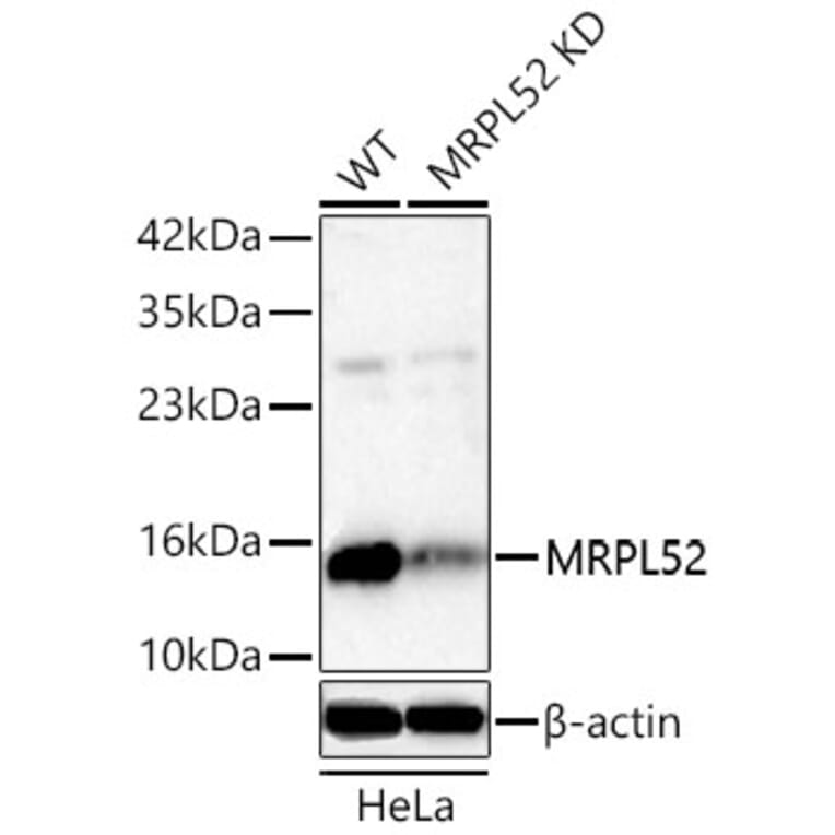 Western Blot - Anti-MRPL52 Antibody (A329637) - Antibodies.com