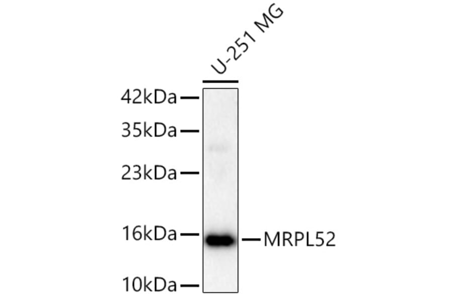Western Blot - Anti-MRPL52 Antibody (A329637) - Antibodies.com