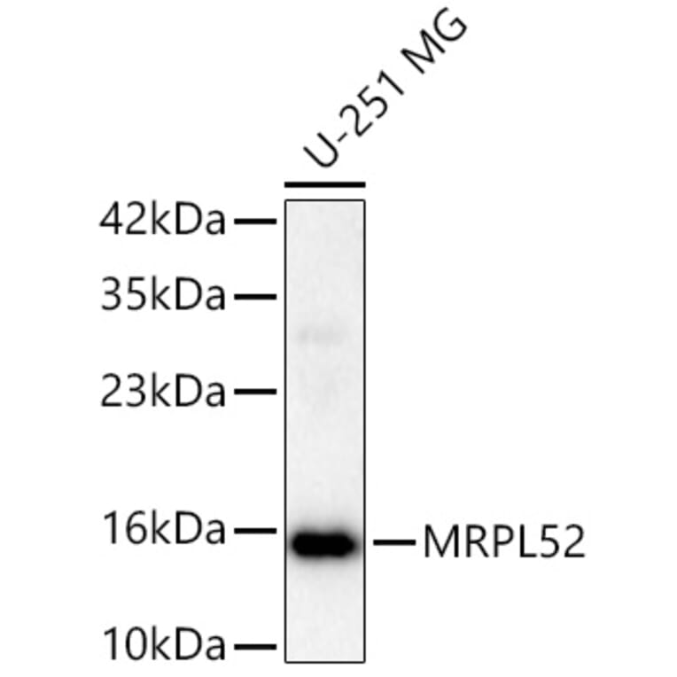 Western Blot - Anti-MRPL52 Antibody (A329637) - Antibodies.com