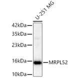 Western Blot - Anti-MRPL52 Antibody (A329637) - Antibodies.com