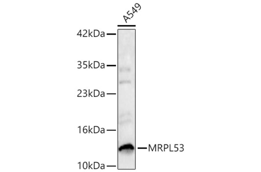 Western Blot - Anti-MRPL53 Antibody (A329638) - Antibodies.com