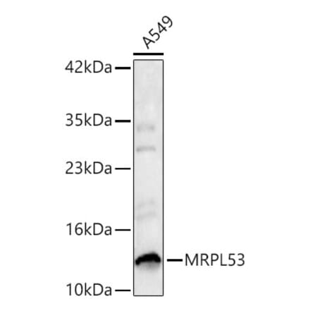 Western Blot - Anti-MRPL53 Antibody (A329638) - Antibodies.com