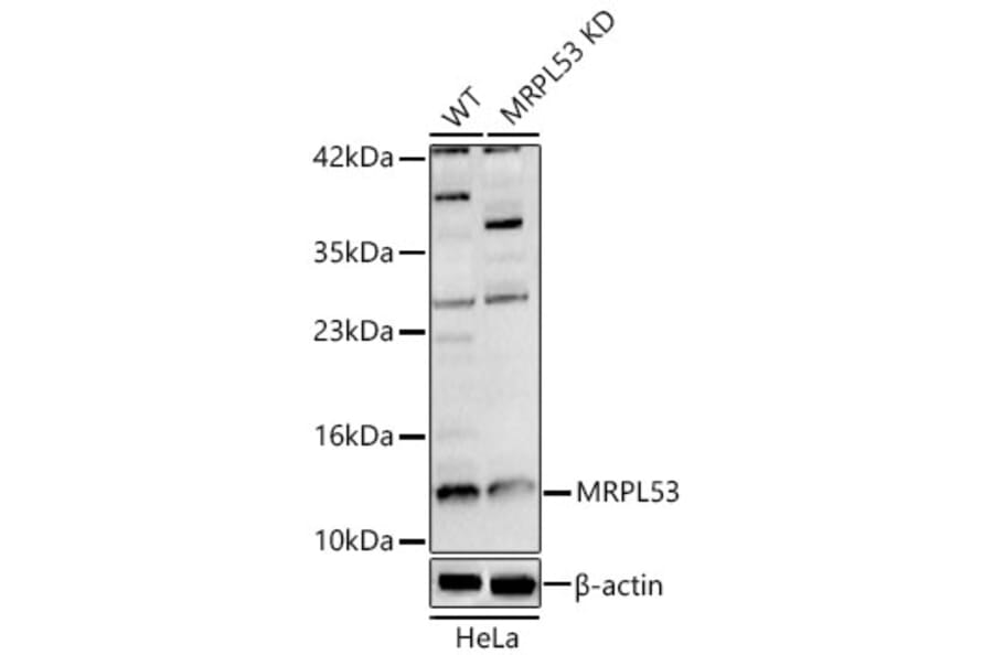 Western Blot - Anti-MRPL53 Antibody (A329638) - Antibodies.com