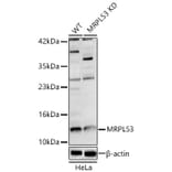 Western Blot - Anti-MRPL53 Antibody (A329638) - Antibodies.com