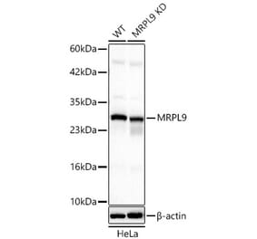 Western Blot - Anti-MRPL9 Antibody (A329639) - Antibodies.com