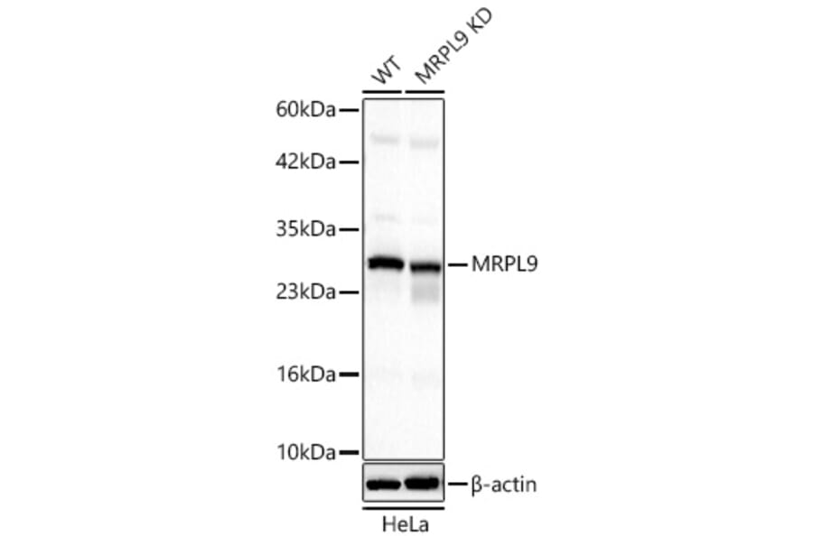 Western Blot - Anti-MRPL9 Antibody (A329639) - Antibodies.com