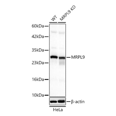 Western Blot - Anti-MRPL9 Antibody (A329639) - Antibodies.com