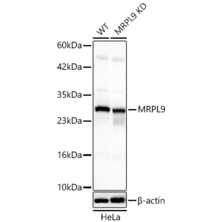 Western Blot - Anti-MRPL9 Antibody (A329639) - Antibodies.com