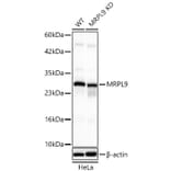Western Blot - Anti-MRPL9 Antibody (A329639) - Antibodies.com
