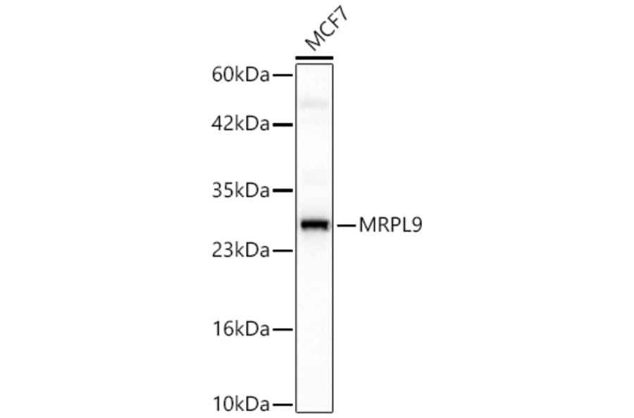 Western Blot - Anti-MRPL9 Antibody (A329639) - Antibodies.com