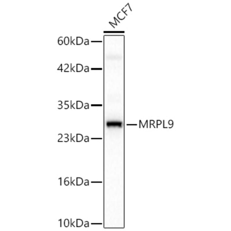 Western Blot - Anti-MRPL9 Antibody (A329639) - Antibodies.com