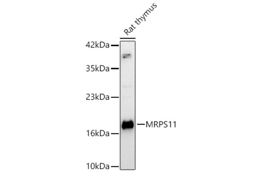 Western Blot - Anti-MRPS11 Antibody (A329640) - Antibodies.com