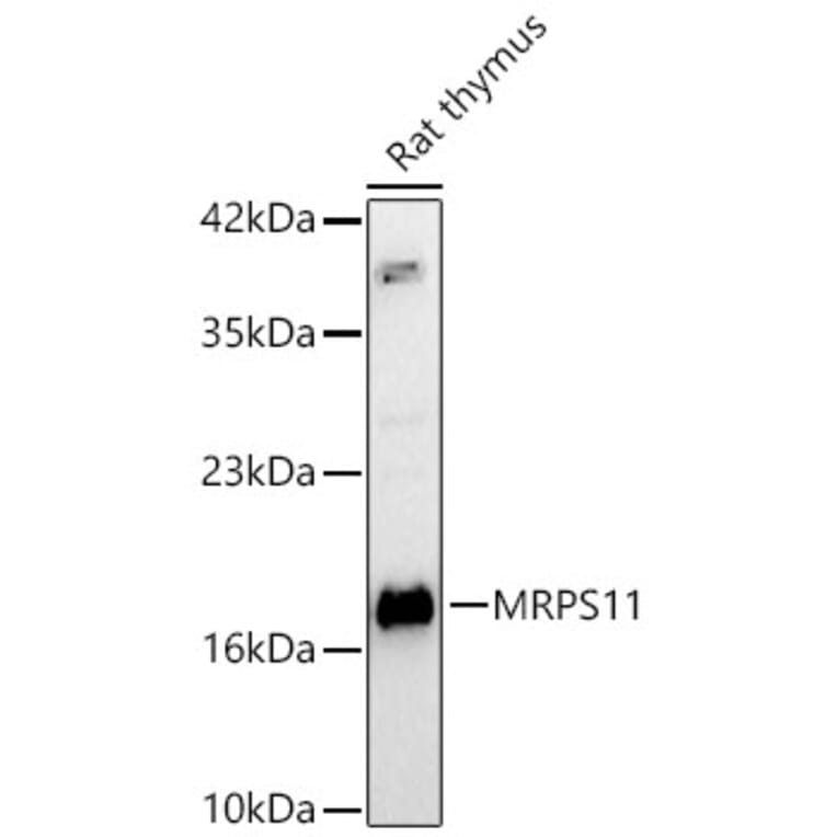 Western Blot - Anti-MRPS11 Antibody (A329640) - Antibodies.com
