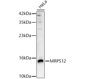 Western Blot - Anti-MRPS12 Antibody (A329641) - Antibodies.com