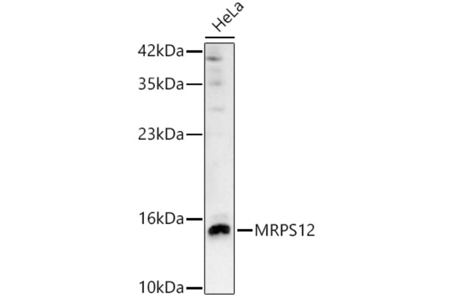Western Blot - Anti-MRPS12 Antibody (A329641) - Antibodies.com