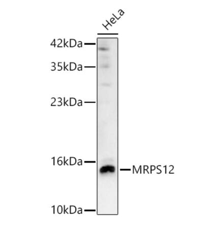 Western Blot - Anti-MRPS12 Antibody (A329641) - Antibodies.com
