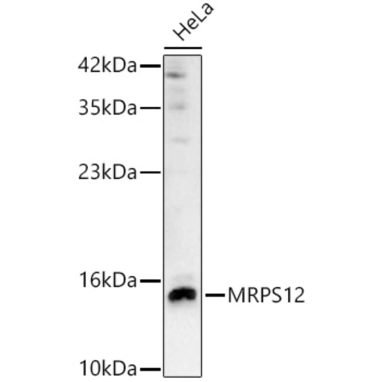 Western Blot - Anti-MRPS12 Antibody (A329641) - Antibodies.com