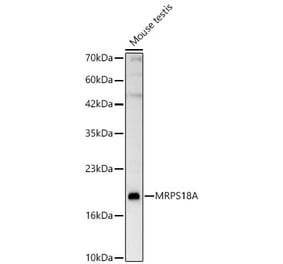 Western Blot - Anti-MRPS18A Antibody (A329642) - Antibodies.com