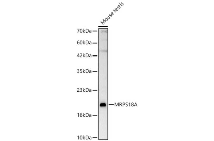 Western Blot - Anti-MRPS18A Antibody (A329642) - Antibodies.com