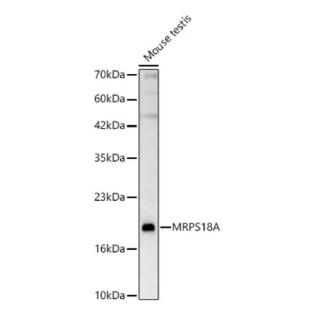 Western Blot - Anti-MRPS18A Antibody (A329642) - Antibodies.com