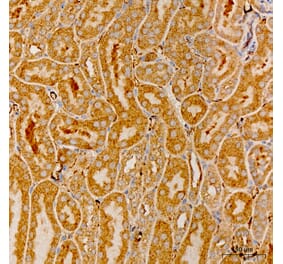 Immunohistochemistry - Anti-MRPS21 Antibody (A329644) - Antibodies.com