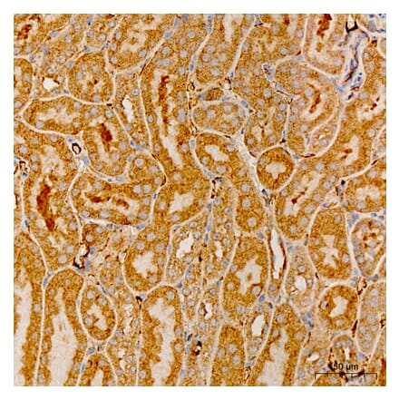 Immunohistochemistry - Anti-MRPS21 Antibody (A329644) - Antibodies.com