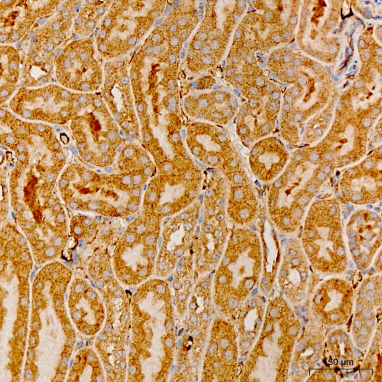 Immunohistochemistry - Anti-MRPS21 Antibody (A329644) - Antibodies.com