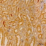 Immunohistochemistry - Anti-MRPS21 Antibody (A329644) - Antibodies.com