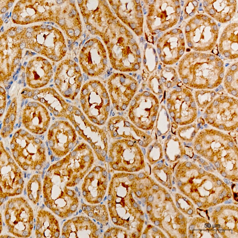 Immunohistochemistry - Anti-MRPS21 Antibody (A329644) - Antibodies.com