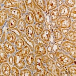 Immunohistochemistry - Anti-MRPS21 Antibody (A329644) - Antibodies.com