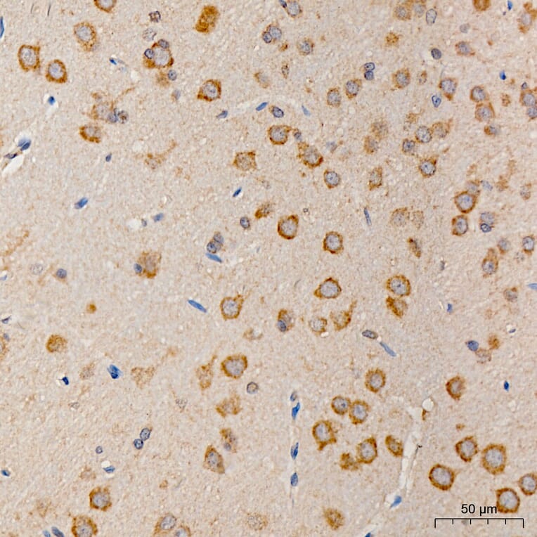 Immunohistochemistry - Anti-MRPS21 Antibody (A329644) - Antibodies.com