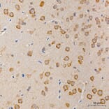 Immunohistochemistry - Anti-MRPS21 Antibody (A329644) - Antibodies.com