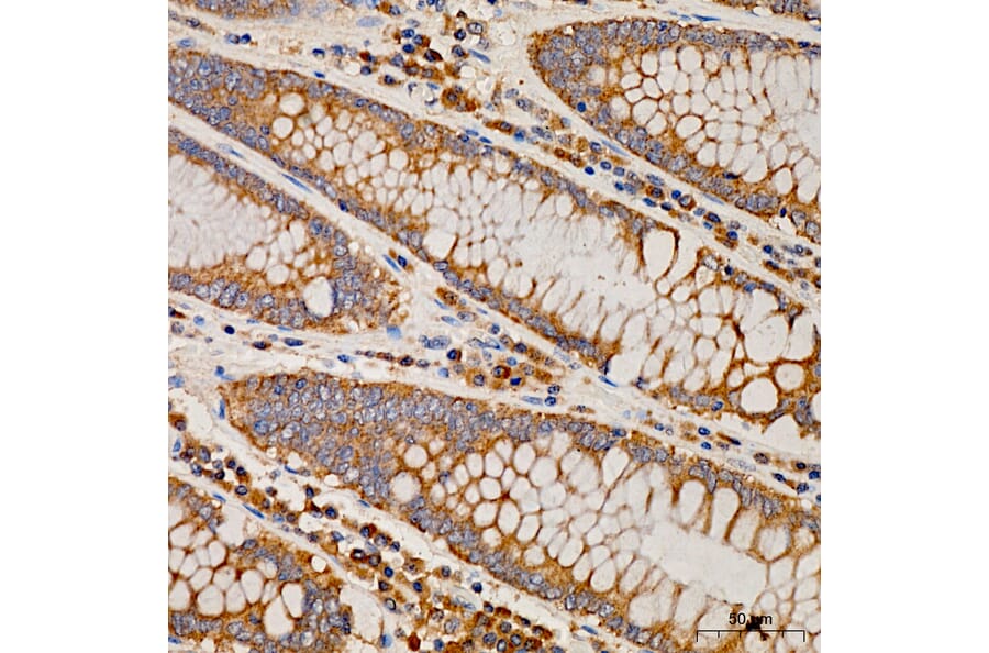 Immunohistochemistry - Anti-MRPS21 Antibody (A329644) - Antibodies.com
