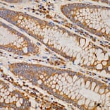 Immunohistochemistry - Anti-MRPS21 Antibody (A329644) - Antibodies.com