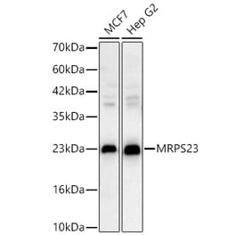 Western Blot - Anti-MRPS23 Antibody (A329645) - Antibodies.com