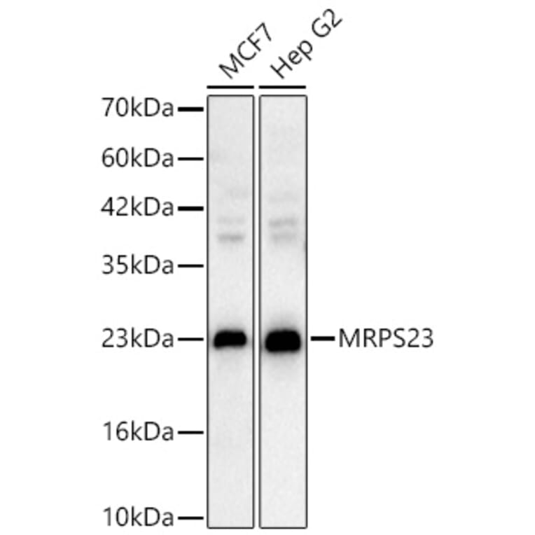 Western Blot - Anti-MRPS23 Antibody (A329645) - Antibodies.com