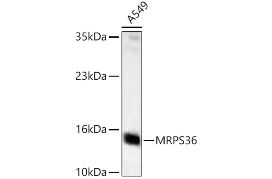 Western Blot - Anti-MRPS36 Antibody (A329646) - Antibodies.com