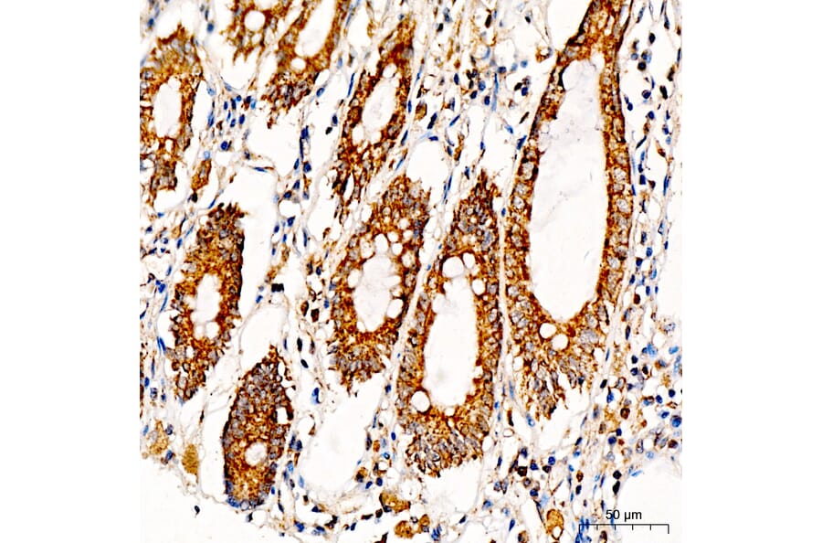 Immunohistochemistry - Anti-MRPS36 Antibody (A329646) - Antibodies.com