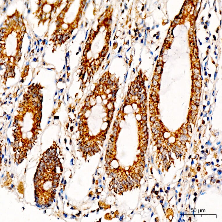 Immunohistochemistry - Anti-MRPS36 Antibody (A329646) - Antibodies.com