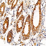 Immunohistochemistry - Anti-MRPS36 Antibody (A329646) - Antibodies.com