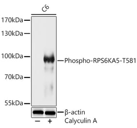 Western Blot - Anti-MSK1 (Phospho T581) Antibody (A329648) - Antibodies.com