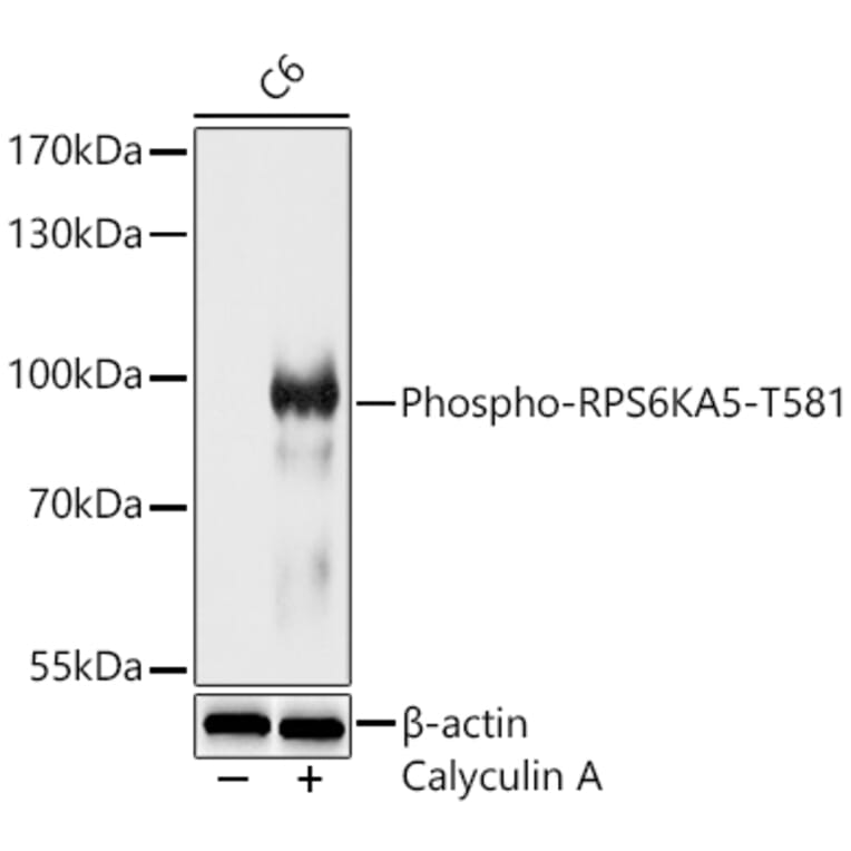 Western Blot - Anti-MSK1 (Phospho T581) Antibody (A329648) - Antibodies.com