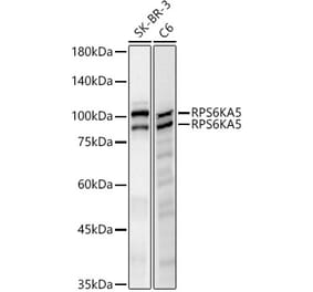 Western Blot - Anti-MSK1 Antibody [ARC61540] (A329649) - Antibodies.com