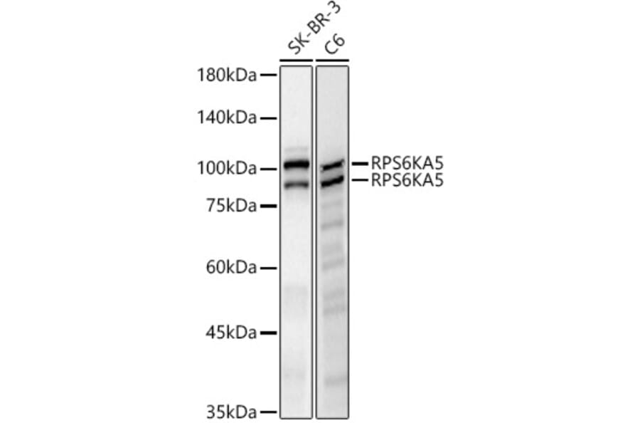 Western Blot - Anti-MSK1 Antibody [ARC61540] (A329649) - Antibodies.com