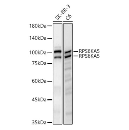 Western Blot - Anti-MSK1 Antibody [ARC61540] (A329649) - Antibodies.com