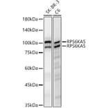 Western Blot - Anti-MSK1 Antibody [ARC61540] (A329649) - Antibodies.com