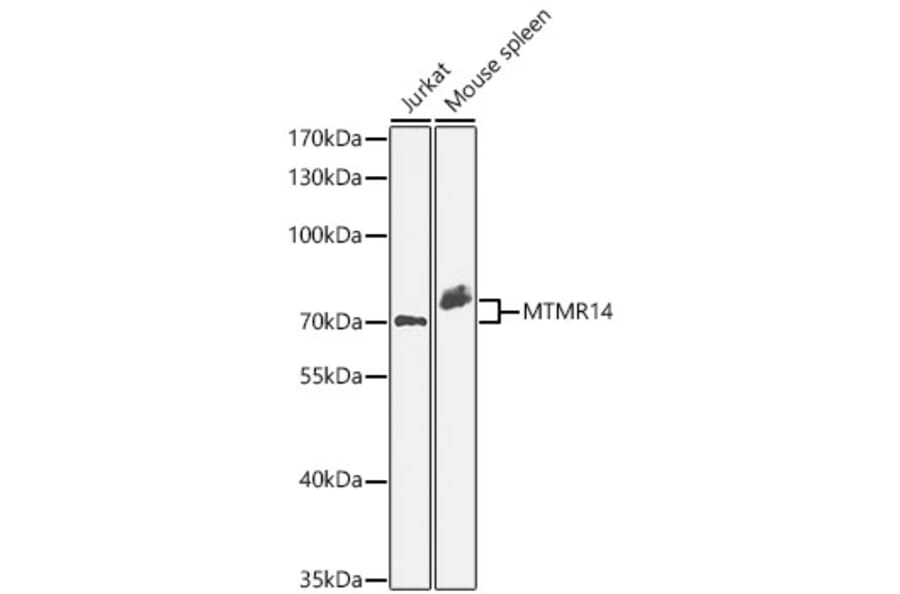 Western Blot - Anti-MTMR14 Antibody (A329650) - Antibodies.com
